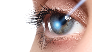 Lasik / Refraktive Chirurgie